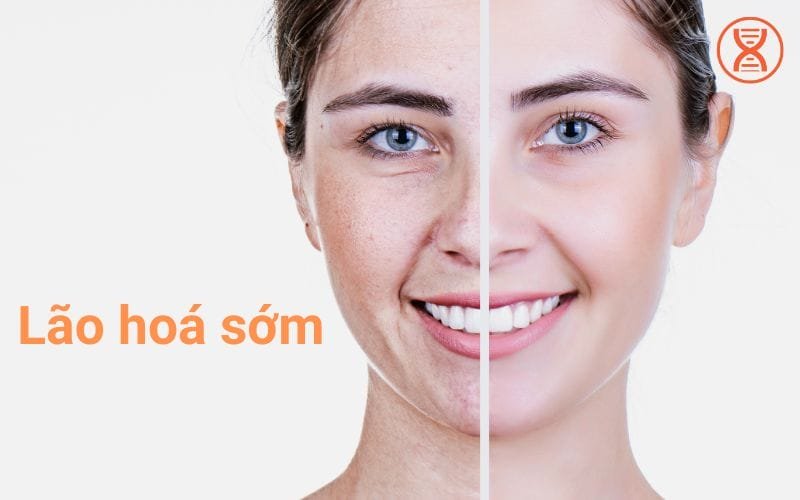 Dinh dưỡng chống lão hoá