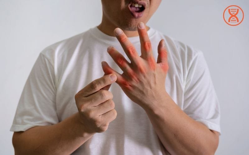 cách trị bệnh gút