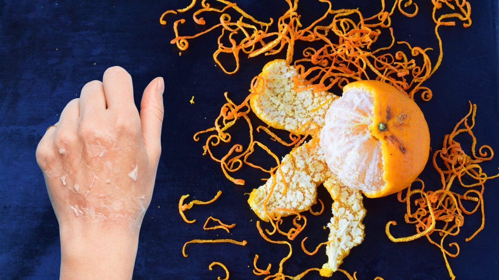 Dinh dưỡng tối ưu cho làn da khô