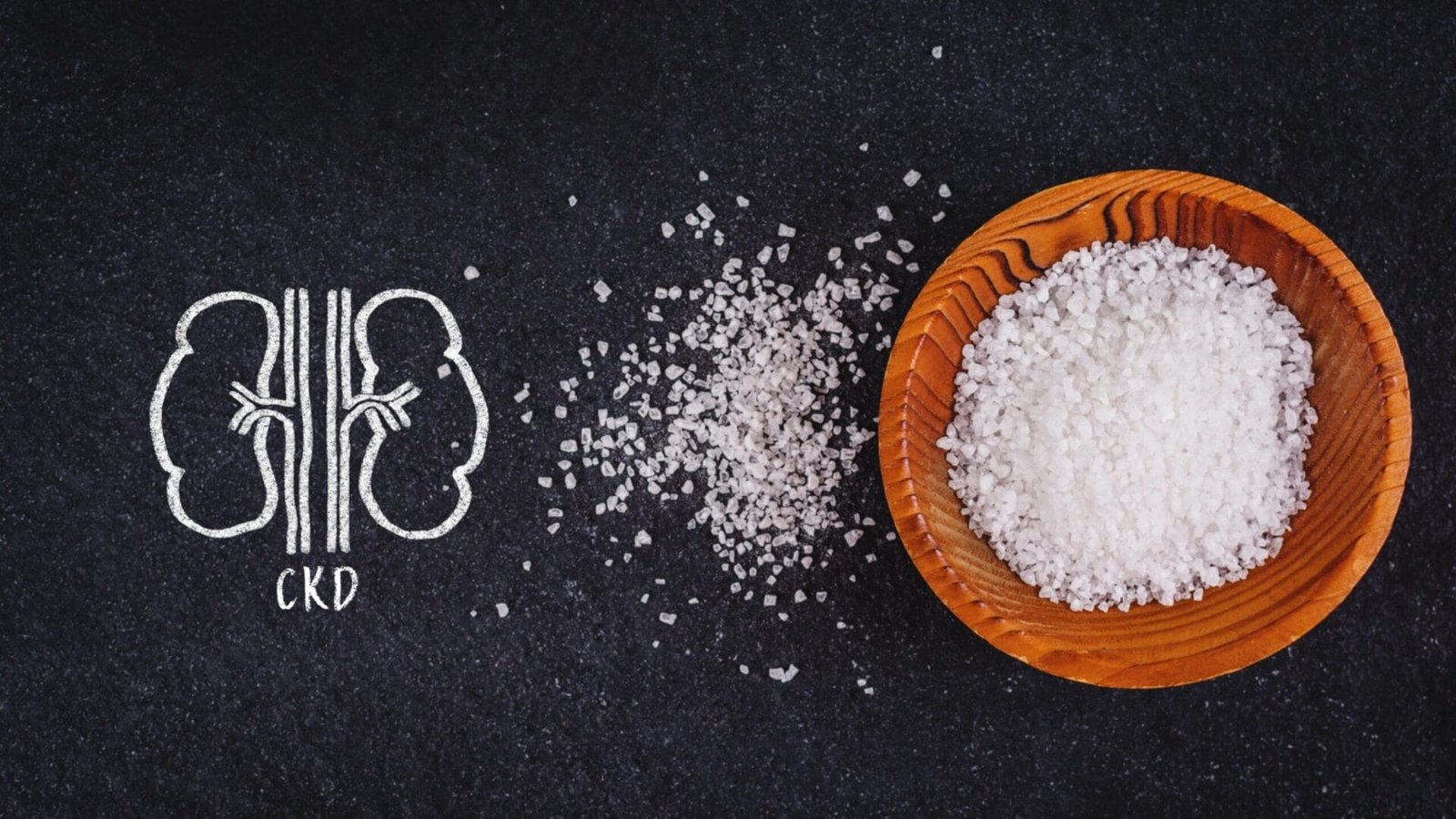 Kiểm soát natri trong bệnh suy thận mạn